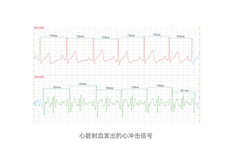 edan监护仪的创新与突破