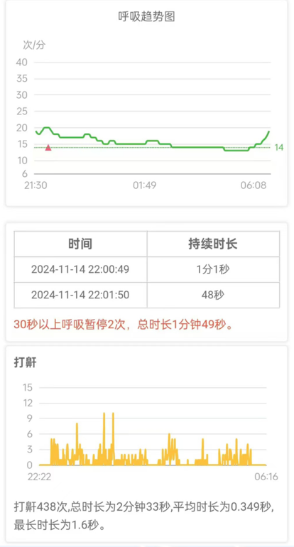 琅智监测心脏健康的仪器