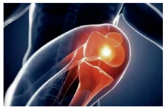 远红外理疗的热效应