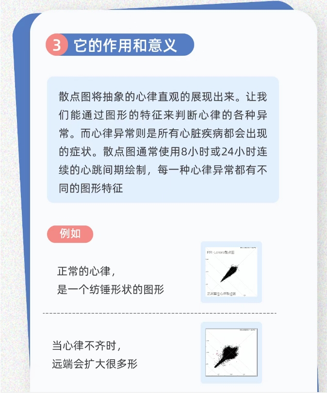 24小时睡眠监测仪